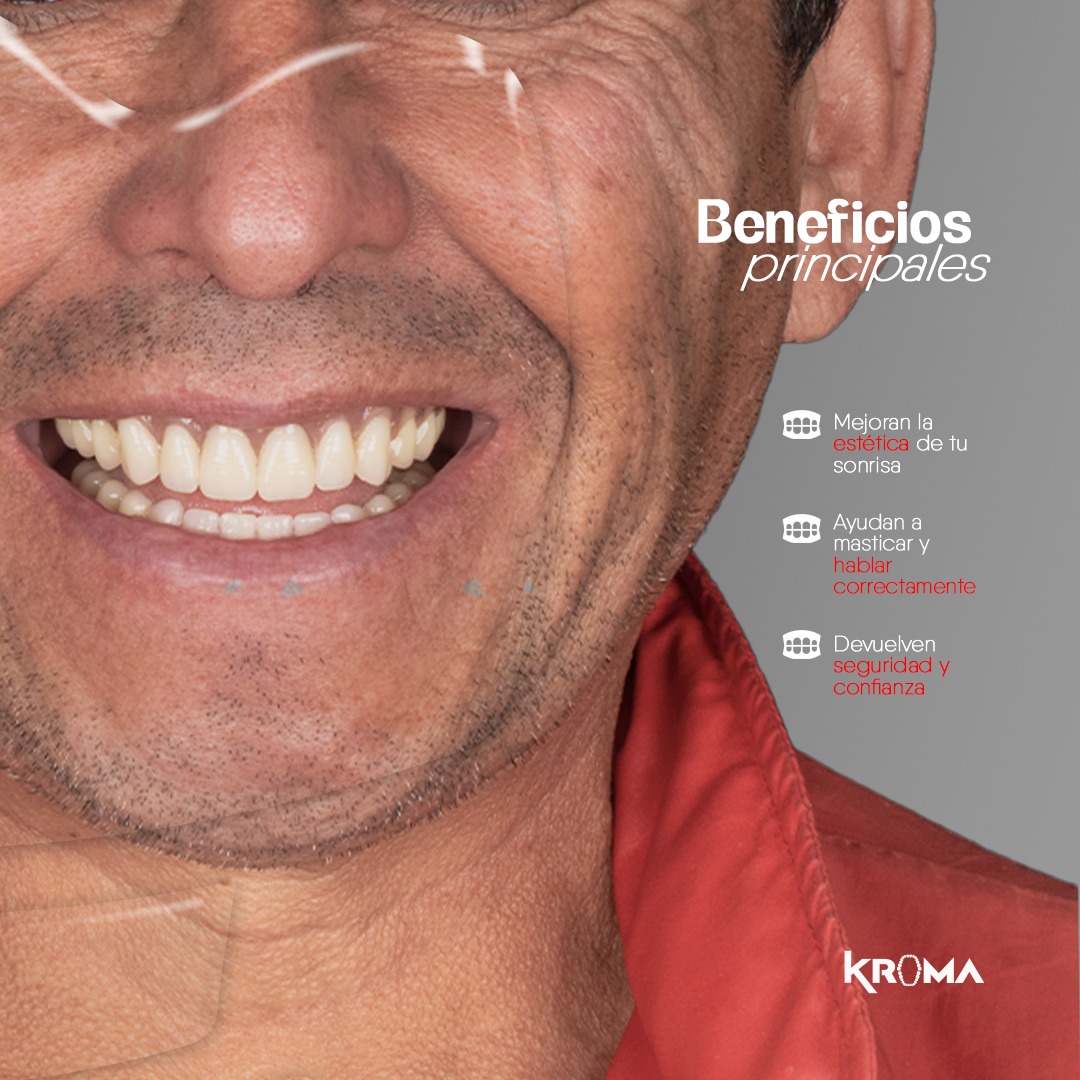 Caso de éxito Kroma