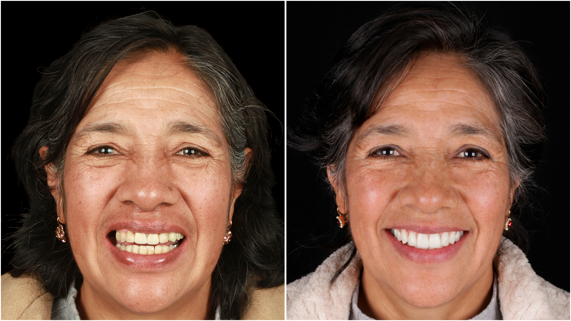 Caso de éxito Kroma