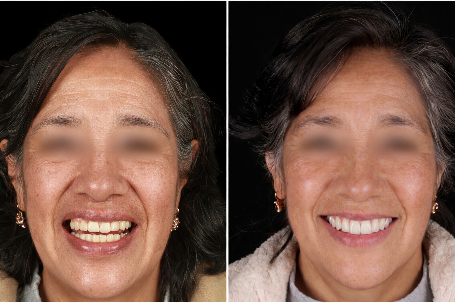 Caso de éxito Kroma